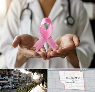 دکتر سرطان پستان در خیابان جمالزاده