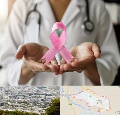 دکتر سرطان پستان در یاسوج