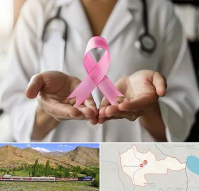 دکتر سرطان پستان در خاش