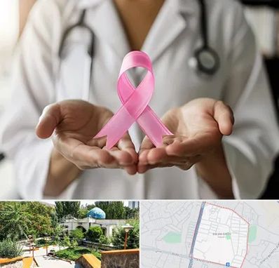 دکتر سرطان پستان در باغمیشه تبریز