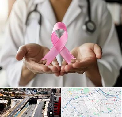 دکتر سرطان پستان در ستارخان شیراز 