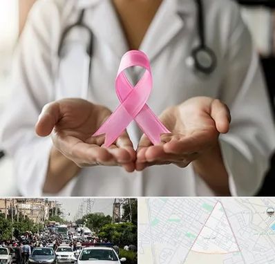 دکتر سرطان پستان در سیدی مشهد