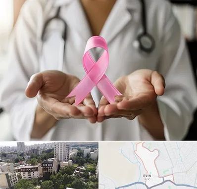 دکتر سرطان پستان در اوین