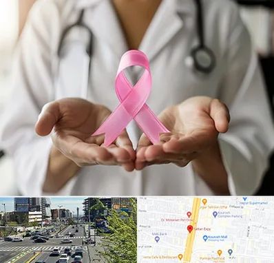 دکتر سرطان پستان در ستاری 