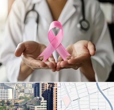 دکتر سرطان پستان در خیابان بهشتی