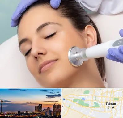 پلاسما جت در غرب تهران تهران