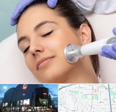 پلاسما جت در بلوار اباذر