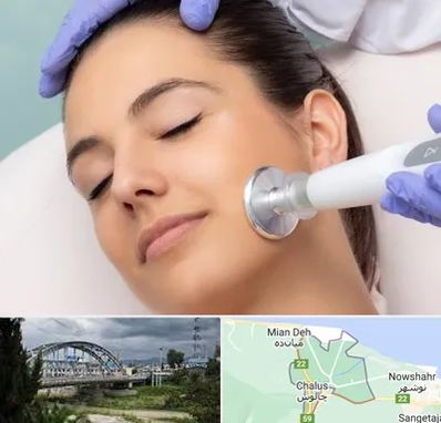 پلاسما جت در چالوس