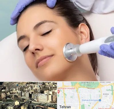 پلاسما جت در مرزداران