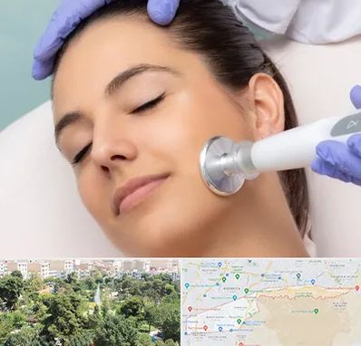 پلاسما جت در منطقه 13 تهران