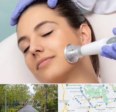 پلاسما جت در قدوسی غربی شیراز