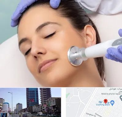 پلاسما جت در چهارراه طالقانی کرج