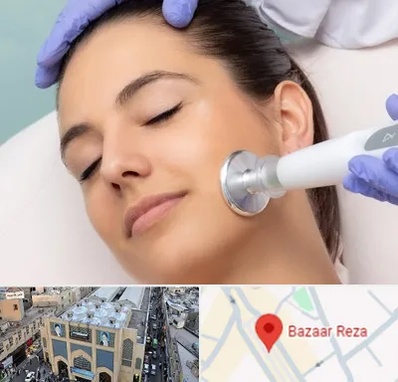 پلاسما جت در بازار رضا مشهد