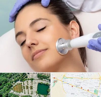 پلاسما جت در وکیل آباد مشهد