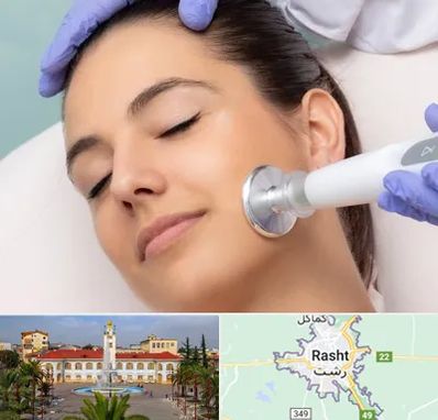 پلاسما جت در رشت