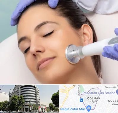 پلاسما جت در قلهک