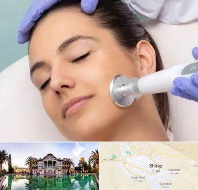 پلاسما جت در شیراز