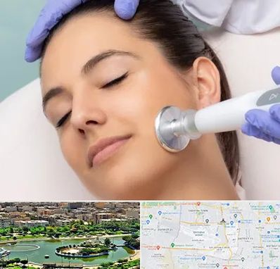 پلاسما جت در منطقه 9 تهران