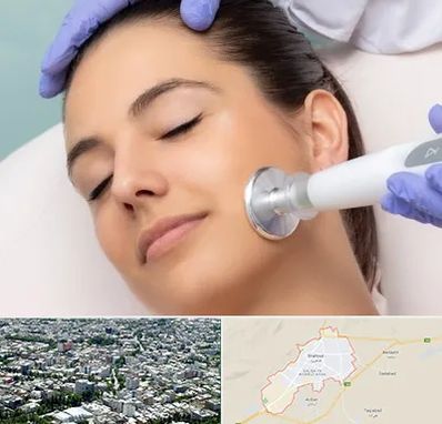 پلاسما جت در شاهرود