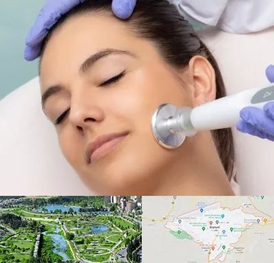 پلاسما جت در بجنورد