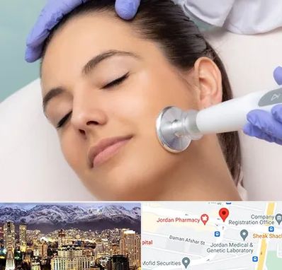 پلاسما جت در جردن