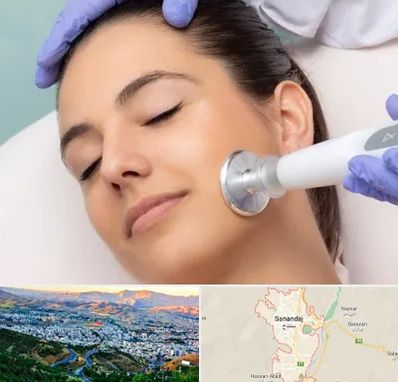 پلاسما جت در سنندج