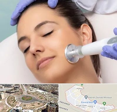 پلاسما جت در پرند