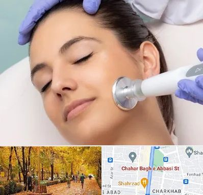 پلاسما جت در چهارباغ اصفهان