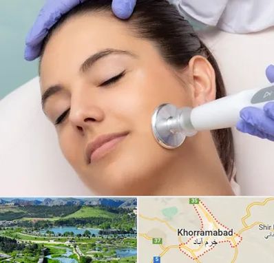 پلاسما جت در خرم آباد