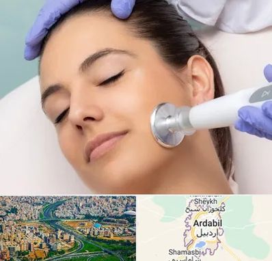 پلاسما جت در اردبیل