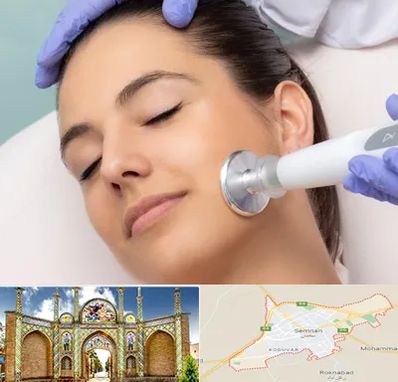 پلاسما جت در سمنان