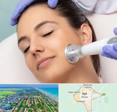 پلاسما جت در ساری