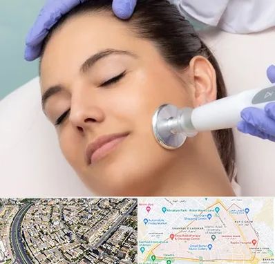 پلاسما جت در شهرک غرب مشهد