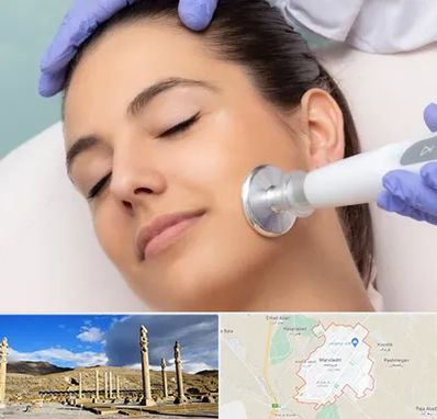 پلاسما جت در مرودشت