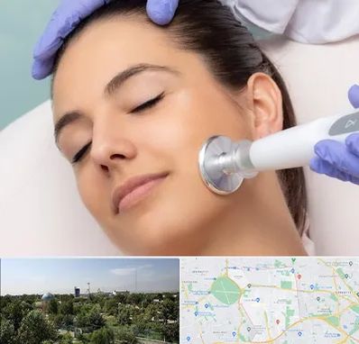 پلاسما جت در منطقه 16 تهران