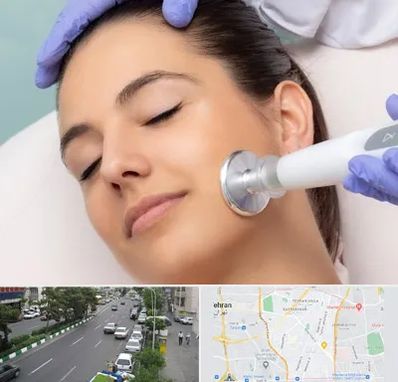 پلاسما جت در ستارخان