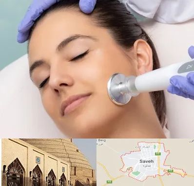 پلاسما جت در ساوه