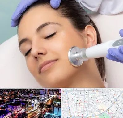 پلاسما جت در منظریه رشت