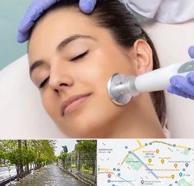 پلاسما جت در خیابان ارم شیراز