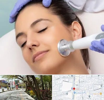 پلاسما جت در خیابان توحید اصفهان