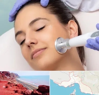 پلاسما جت در هرمزگان