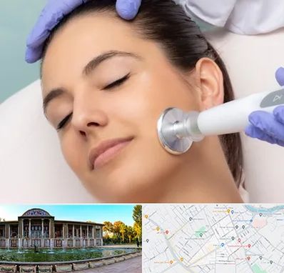 پلاسما جت در عفیف آباد شیراز