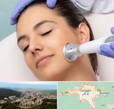 پلاسما جت در گرگان
