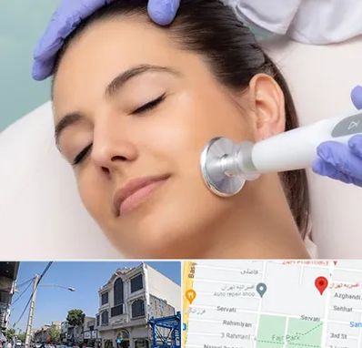 پلاسما جت در افسریه