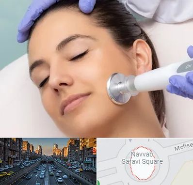 پلاسما جت در نواب