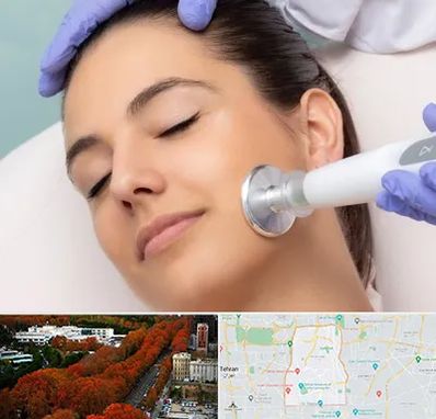 پلاسما جت در منطقه 6 تهران