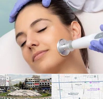 پلاسما جت در مرکز تهران