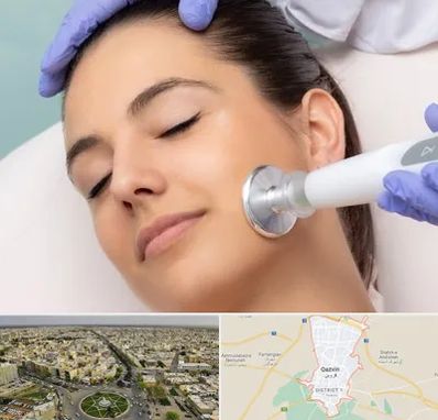 پلاسما جت در قزوین