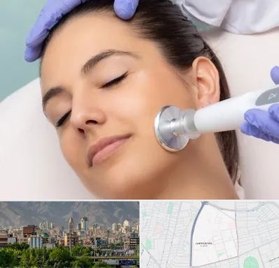 پلاسما جت در جمشیدیه