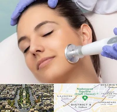 پلاسما جت در نارمک